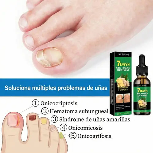 7 Days Nails – El tratamiento que elimina los hongos de las uñas y las deja fuertes, limpias y saludables